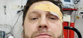 După Alaiba, încă un deputat PAS a venit la Parlament accidentat
